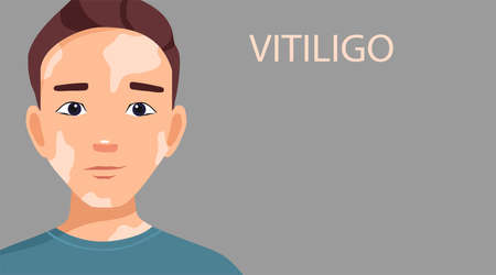 Portrait of a guy with vitiligo. Self-love. World vitiligo day. Skin diseases. Vector illustration in cartoon style with space for textのイラスト素材