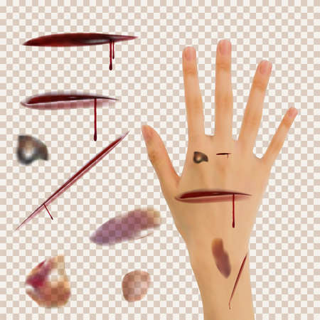 Set of cuts, bruises. Using the transparency effect to any background color, image jpg, jpeg, png, photo of the skin. A realistic wrist as an example. Vector eps10.のイラスト素材