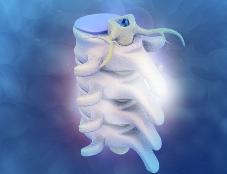 Arthritis of the Spine. 3d illustration