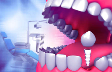 Human tooth with Dental Chair. Dental Services. 3d illustration の写真素材