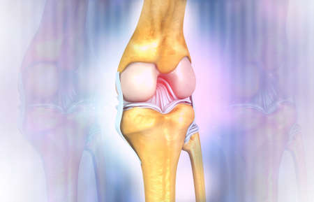 knee joint arthritis on abstract background. 3d renderの写真素材