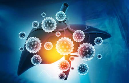 Virus attacks human liver. 3d illustration	の写真素材