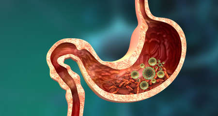 Cross section of human stomach with viruses and bacteria. 3d illustration	の写真素材