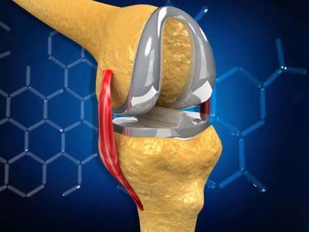 Knee replacement concept. 3d illustrationの写真素材