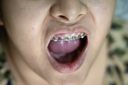 young girl showing her teeth bracing to dentist from different angleの写真素材
