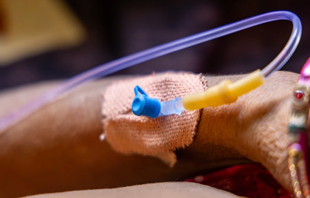 patient hand with IV cannula in clinical environment at indoorの写真素材