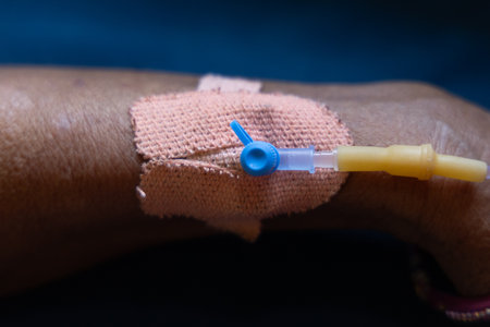 patient hand with IV cannula in clinical environment at indoorの写真素材