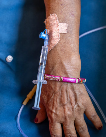 injection thorough cannula inserted in patientâs hand during daytime indoorsの写真素材