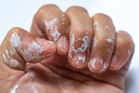 Woman's hand be stained with white acrylic glazing putty on white background,Close up & Macro shot, Selective focus, Home conceptの写真素材