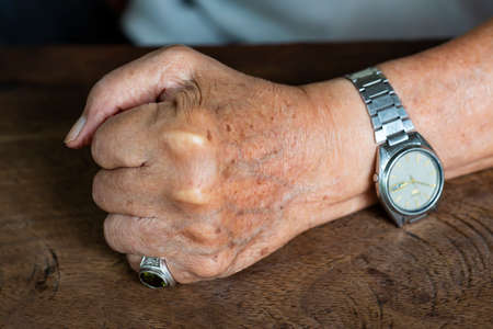 Senior man's left hand in fist on wood table background, Mole and blemish, Close up & Macro shot, Selective focus, Asian body skin part, Symbol, Gesturing, Body Language Conceptの写真素材