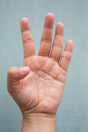 Trigger Finger lock on thumb finger of woman's front left hand, Suffering from pain, On Blue-grey colour background,  Close up & Macro shot, Office syndrome, Health care conceptの写真素材