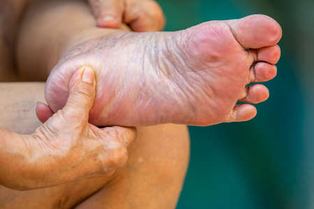 Senior woman's hand massaging her foot, Swimming pool, Close up shot, Selective focus, About massage conceptの写真素材
