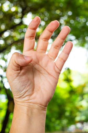 Trigger Finger lock on thumb finger of woman's front left hand, Suffering from pain, in bokeh green...