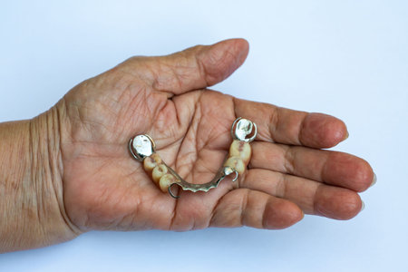 Senior woman's hand holding Artificial teeth, Acrylic and Vitallium metal, On white background,...