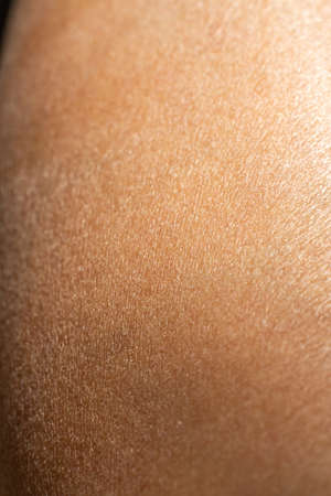 Woman's dry skin on leg, Close up & Macro shot, Asian skin tone, Abstract backgroundの写真素材