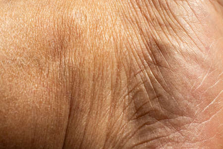 Woman's dry skin on ankle, Close up & Macro shot, Asian Body skin part, Healthcare concept, Abstract backgroundの写真素材