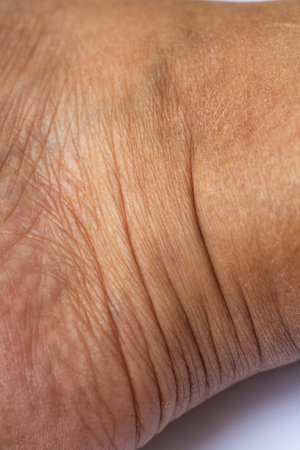 Woman's dry skin on ankle, Close up & Macro shot, Asian Body skin part, Healthcare concept, Abstract backgroundの写真素材