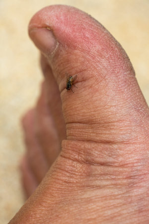 Woman's dry skin on foot with Housefly, Close up & Macro shot, Selective focus, Asian body skin...
