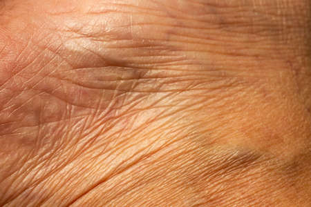 Woman's dry skin on ankle, Close up & Macro shot, Asian Body skin part, Healthcare concept, Abstract backgroundの写真素材