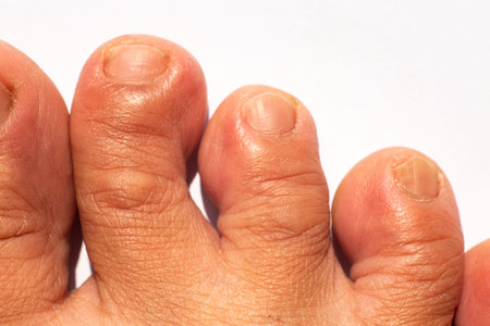 Women's crooked second toes, middle toe, fourth toe, Dry skin on white background, Close up & Macro...