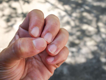 Woman nibbling nails, Close up and macro shot, Selective focus, Asian body Language conceptの写真素材