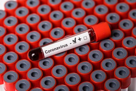 Covid 19 infected blood sample in sample tube on table in research laboratory.
