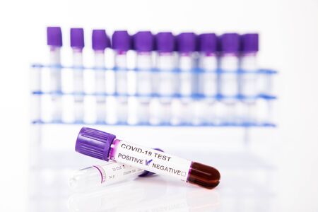 Healthcare to aid recovery from coronavirus COVID-19: An oxygen mask, surgical gloves and...