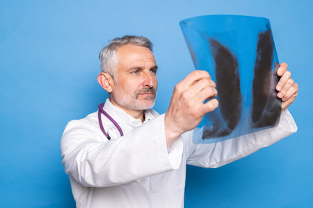 doctor shows his hand on x-ray on a blue backgroundの写真素材