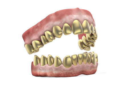 Jaw with golden teeth isolated on white backgroundの写真素材