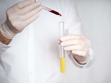 Covid-19 medicine diagnostic hospital laboratory testing doctor vaccination corona virusの写真素材