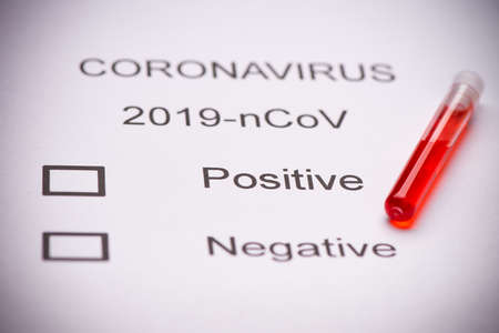 Middle East respiratory syndrome coronavirus test tube containing MERS-CoV close upの写真素材