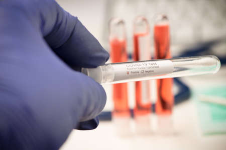 Blood test for COVID-19. Examination of a blood sample for the presence of SARS-CoV-2 coronavirus...
