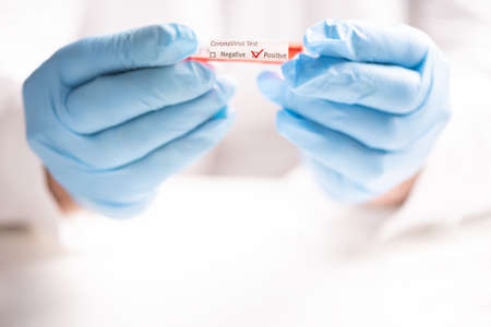 Doctor holding Coronavirus blood test tube. Close upの写真素材