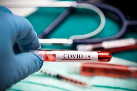 Doctor hands holding COVID 19 Coronavirus test blood. Close upの写真素材