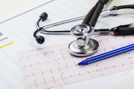 metal stethoscope on cardiogramの写真素材