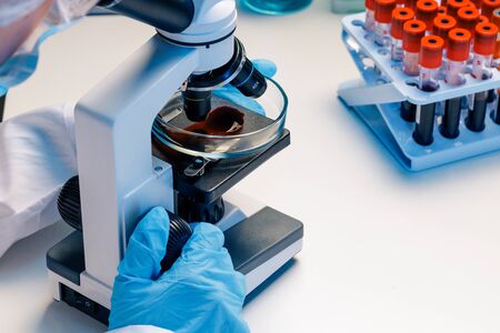 Hands of a laboratory worker doing blood test