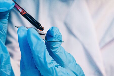 Hands of a laboratory worker doing blood test