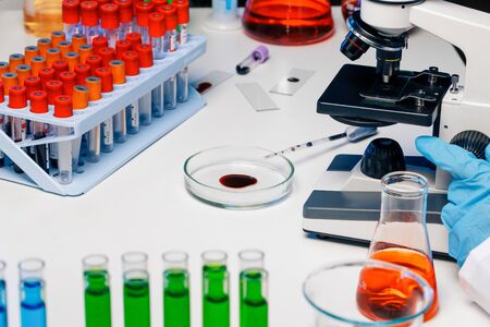 Hands of a laboratory worker doing blood testの写真素材