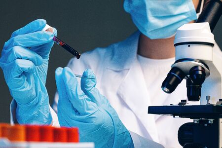 Hands of a laboratory worker doing blood test, close up