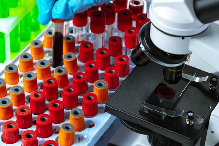 Scientists hands doing chemical research with the help of microscopeの写真素材