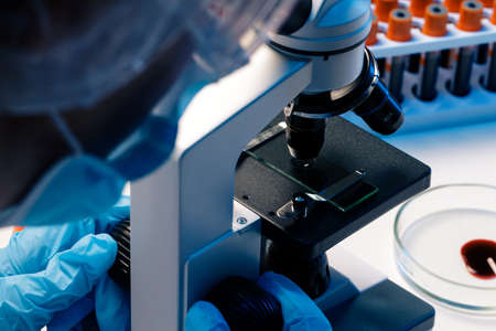 Hands of a laboratory worker doing blood test, close up