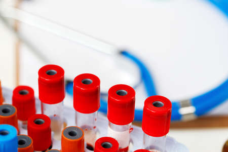 Test tubes tops in a tray close up