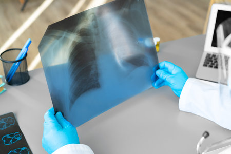 Doctor examining lungs x-ray scan in his office in hospitalの写真素材