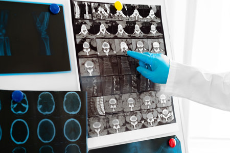 Hands of a doctor holding head mri scanの写真素材