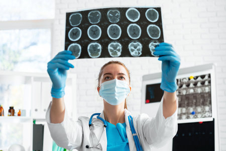 Woman doctor examines head mri scan in hospital