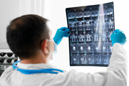 Senior man doctor in mask examines head MRI in hospitalの写真素材