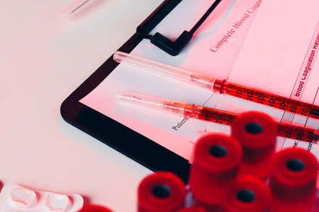 Close-up of test tubes arranged on a table in medical laboratoryの写真素材