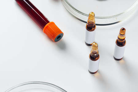 Blood test analysis with Petri dish close upの写真素材