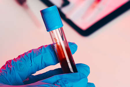 Doctors hands in blue gloves keep test tube with a blood