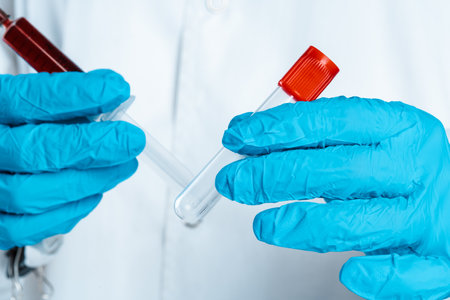 Doctor in blue gloves keep in hands test tube with a blood and syringe
